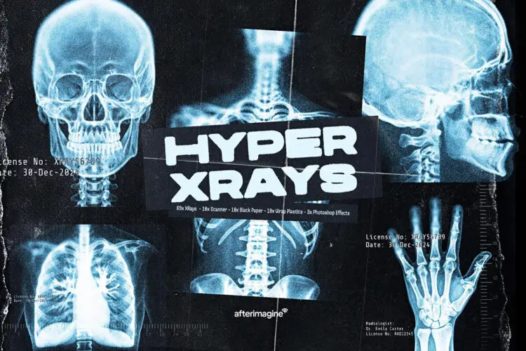69款潮流未来科幻X射线骨骼X光扫描科技海报背景高清图片设计素材 Hyper XRays Collection